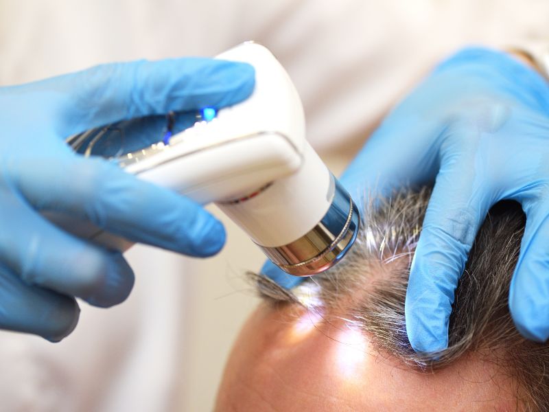 pcm tricologia tratamento lazer